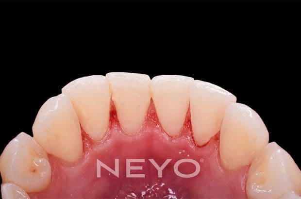 NEYO Dental specialist - Hygienist after