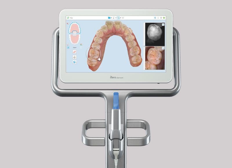 NEYO - iTero Scanner by Invisalign.