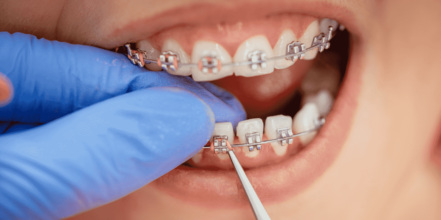 Orthodontist West Sussex