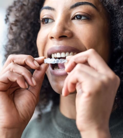 before and after clear aligners