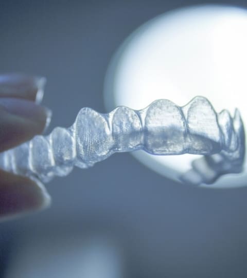 photo of invisible braces